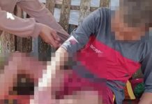 Trauma Usai Dibakar Teman, Santri di Lombok Rindu Kembali ke Bangku Sekolah